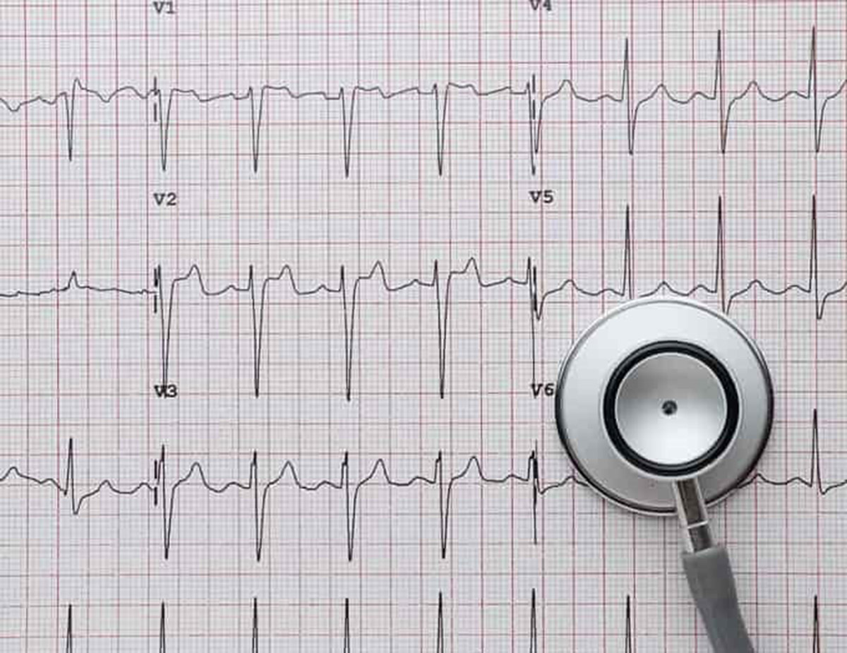 Экг в платной клинике. ЭКГ. Электрокардиография (ЭКГ). Измерение ЭКГ. Кардиограмма сердца.