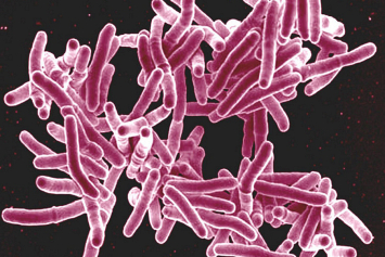 Туберкулез можно перенести и не заметить