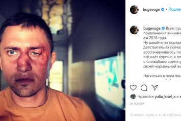 Павла Прилучного выписали из больницы: в Instagram Stories актер отдыхает у себя дома
