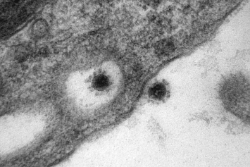 Ученые впервые сделали фото дельта-штамма коронавируса