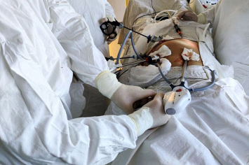 Хирурги Витебского ОКСЦ удалили редкую опухоль желудка и спасли жизнь пациентке