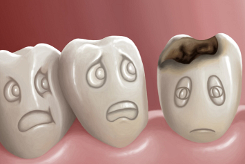 Свои зубы до старости — это реально? Стоматолог раскрыл секреты улыбки мечты