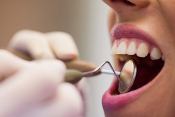 Как восстановить поврежденную зубную эмаль – объясняет врач