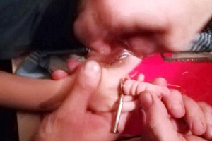 В Минске палец четырехлетнего ребенка застрял в отверстии ключа. Выезжали спасатели