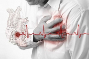 Инфаркт миокарда: промедление смерти подобно